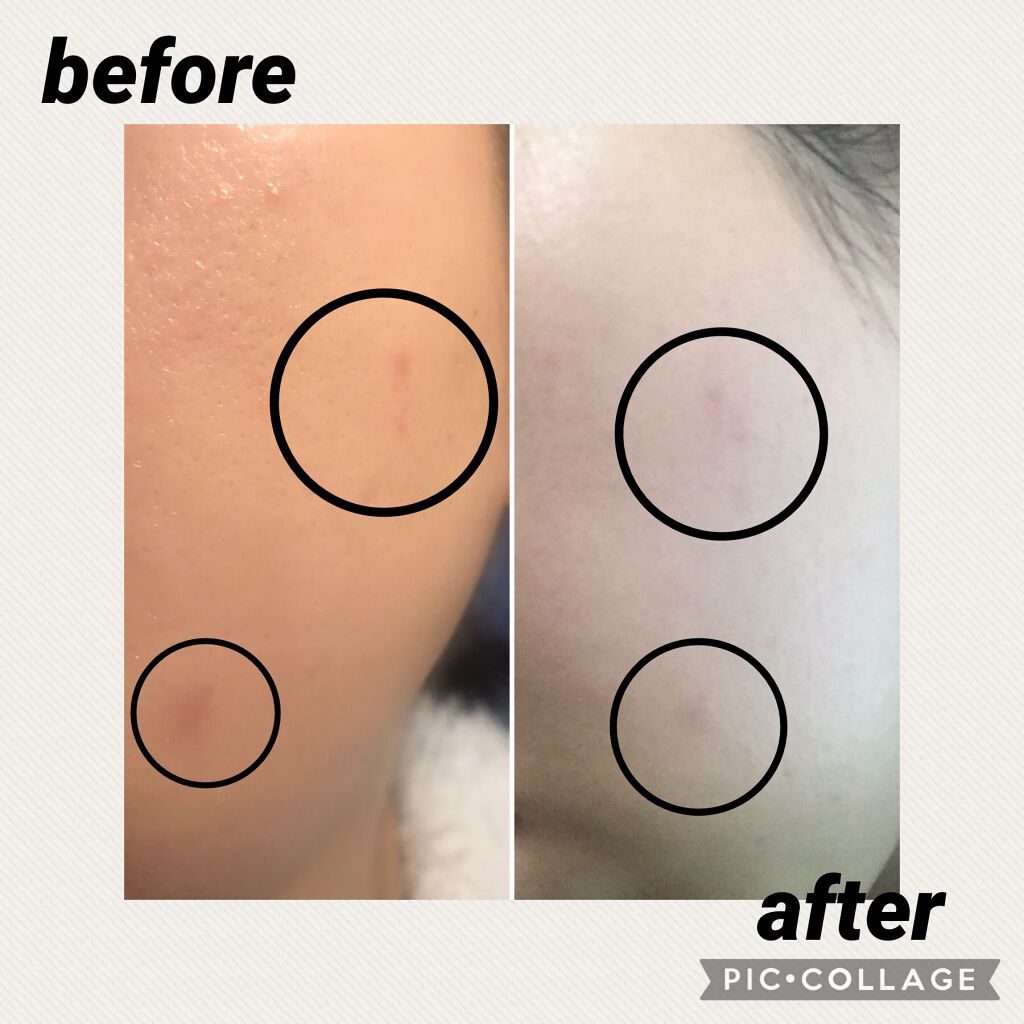 エポホワイティア ダブルエンリッチメント/NO GRAVITY/美容液を使ったクチコミ（3枚目）