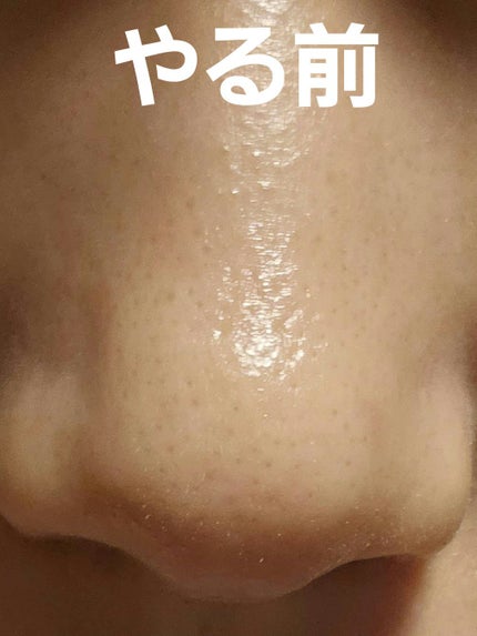 毛穴モップ (3STEP NOSE PACK)/YAMMY’S TOY/洗い流すパック・マスクを使ったクチコミ(4枚目)