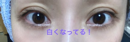 スマイルホワイティエ(医薬品)/ライオン/その他を使ったクチコミ(2枚目)