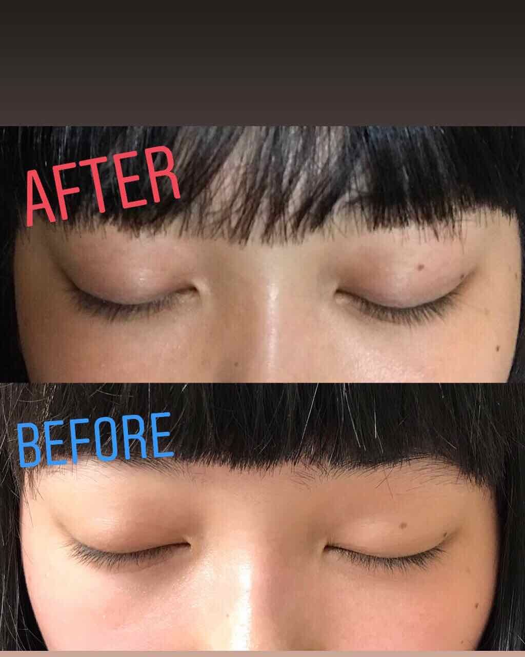 コエンザイムQ10配合 美容液/DAISO/美容液を使ったクチコミ（2枚目）