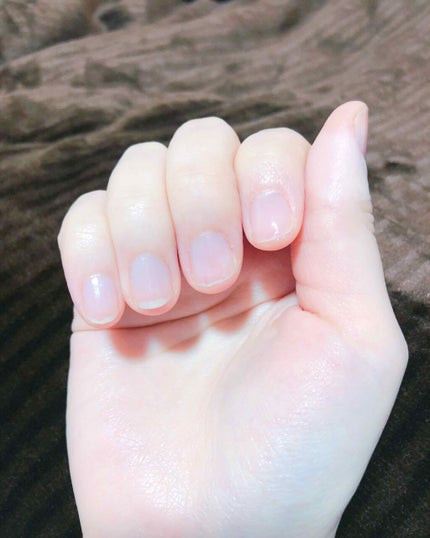 ネイルエンビー/O・P・I/ネイルオイル・トリートメントを使ったクチコミ(2枚目)