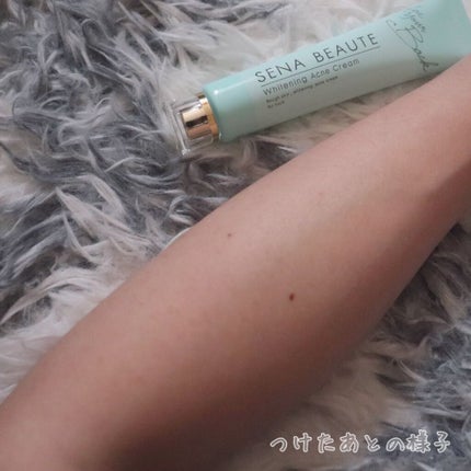 セナボーテ/株式会社フロンティア/ネック・デコルテケアを使ったクチコミ(4枚目)