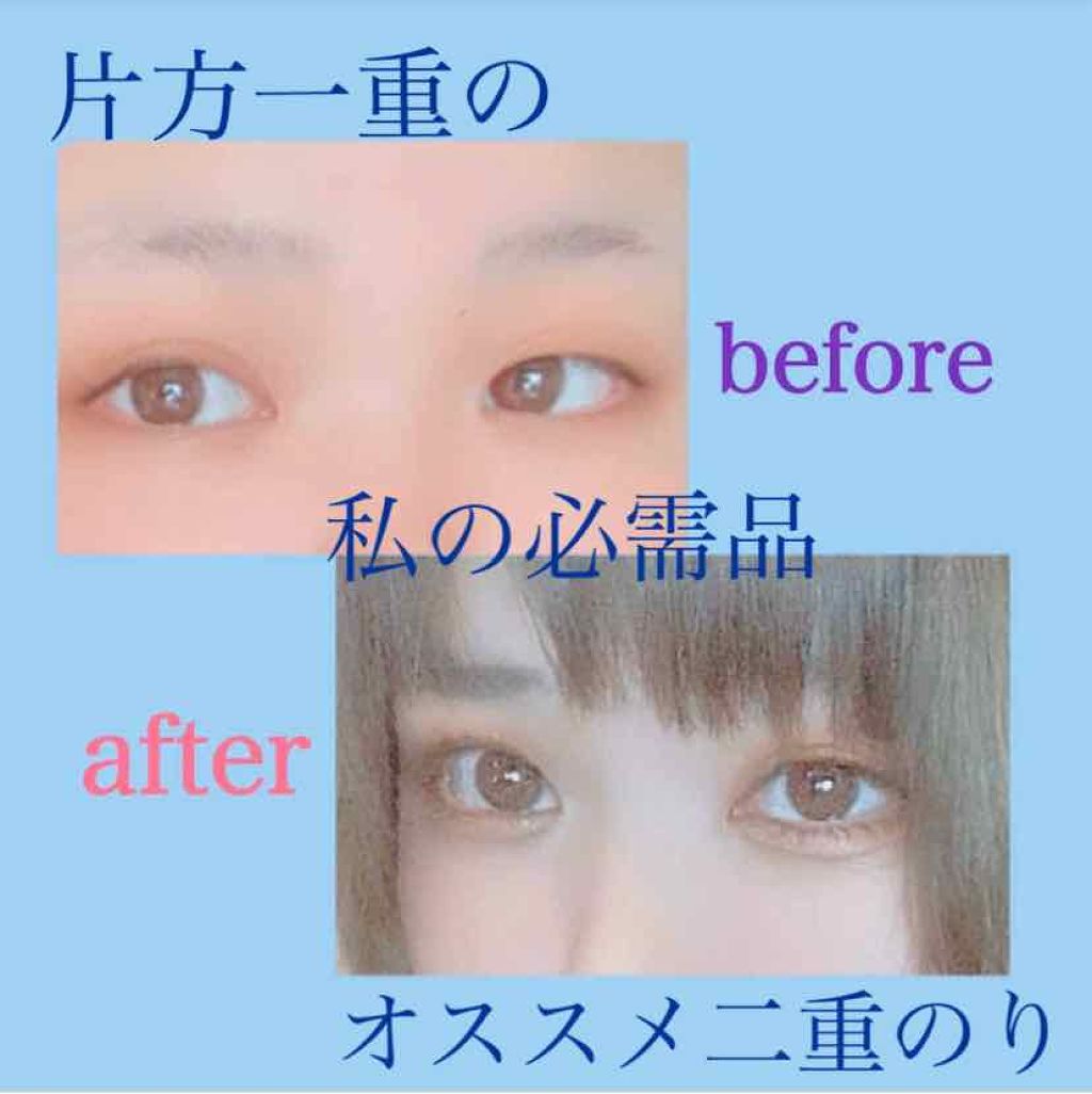 アイビューティー フィクサー WP/アストレア ヴィルゴ/二重まぶた用アイテムを使ったクチコミ(1枚目)