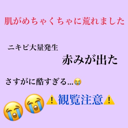 明色美顔水 薬用化粧水/美顔/化粧水を使ったクチコミ(1枚目)