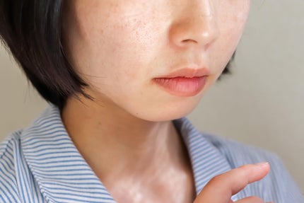 肌潤改善エッセンス/米肌/美容液を使ったクチコミ(3枚目)