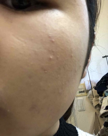 タイムシークレット ミネラルプレストパウダー/TIME SECRET/プレストパウダーを使ったクチコミ(2枚目)