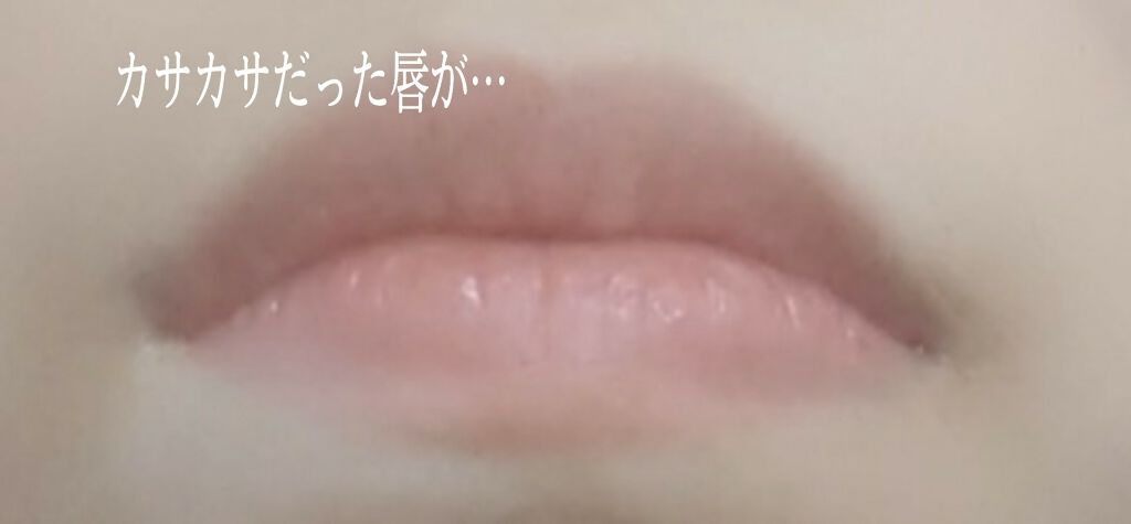 DHC 薬用リップクリーム アリス フラワー/DHC/リップクリームを使ったクチコミ（2枚目）