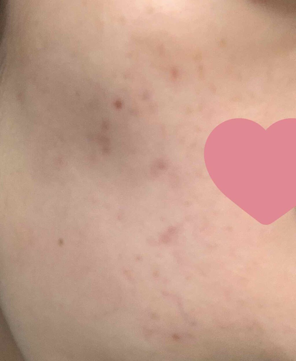 AHA·BHA·PHA 30デイズミラクルトナー/SOME BY MI/化粧水を使ったクチコミ（2枚目）