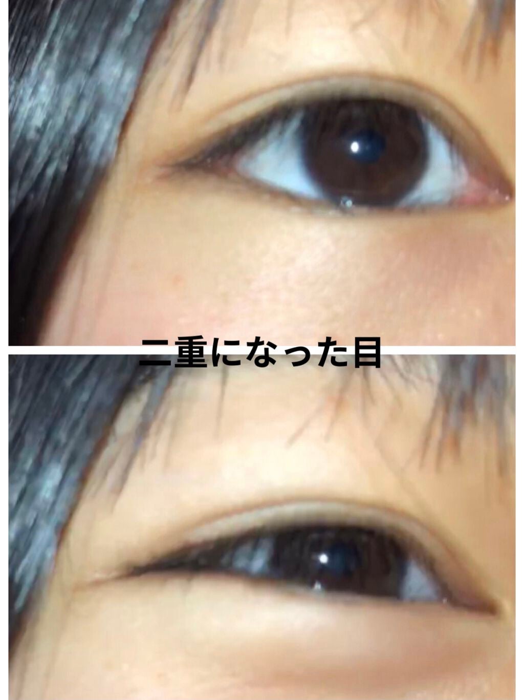 ゆらん︎︎ on LIPS 「中2の私がたった1週間で奥二重から二重にしたやり方を教えようと..」(2枚目)