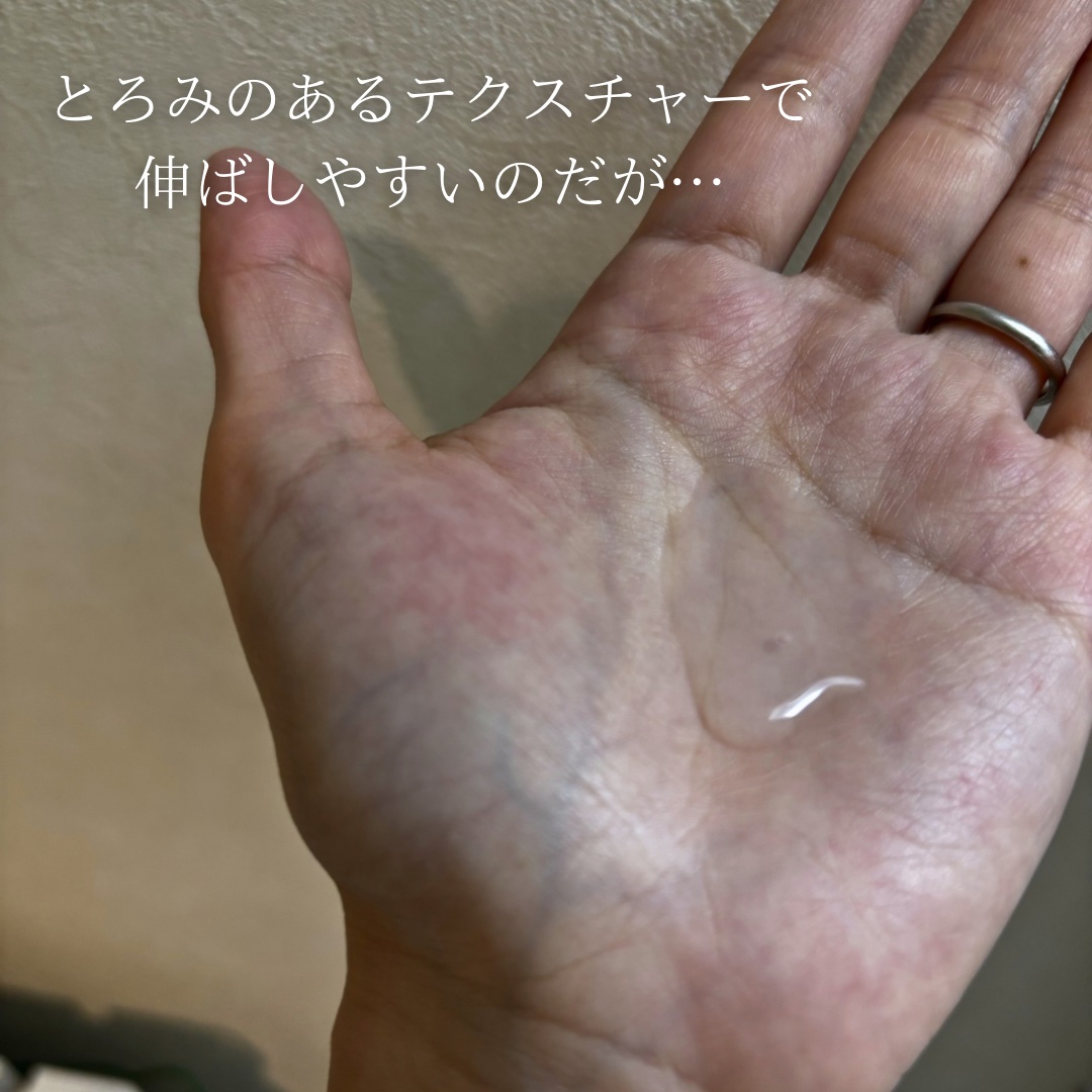 薬用高保湿化粧水/乾燥さん/化粧水を使ったクチコミ（3枚目）