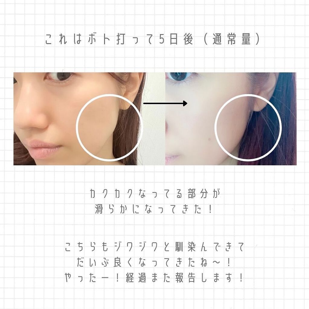 ãªãŒãð«§ãããã»èèããçŸèã« on LIPS ã仿¥ã¯ãããã¯ã¹æã£ãŠããããïŒã®å ±åïŒâ¡æã£ãŠ5æ¥çµã£ãã®ã§..ãïŒ4æç®ïŒ