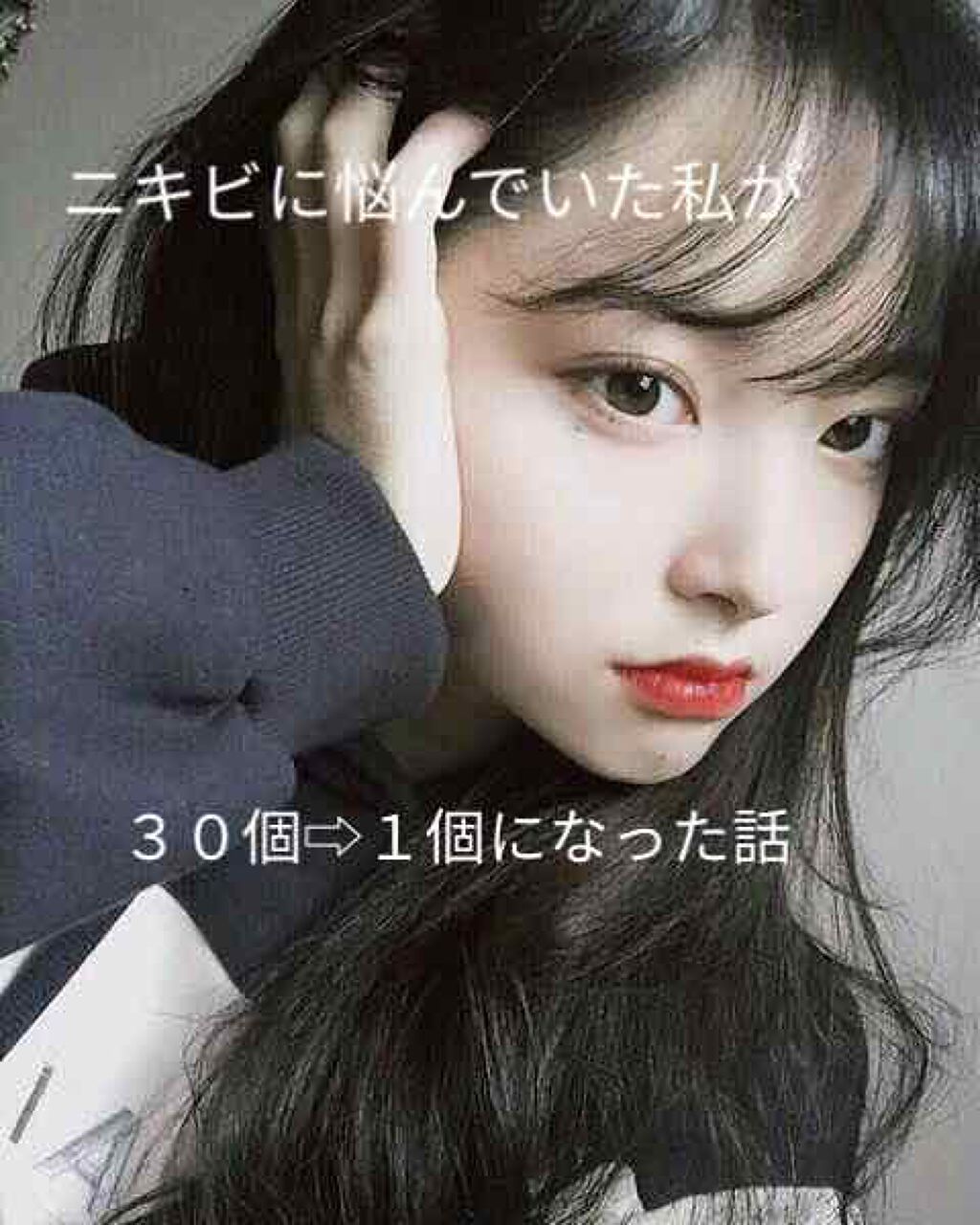 オロナインH軟膏 (医薬品)/オロナイン/その他を使ったクチコミ(1枚目)