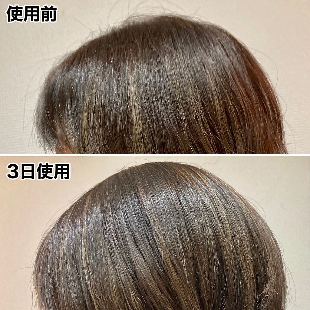 ザ・オリジナル ノーマル/TANGLE TEEZER/ヘアブラシを使ったクチコミ(4枚目)