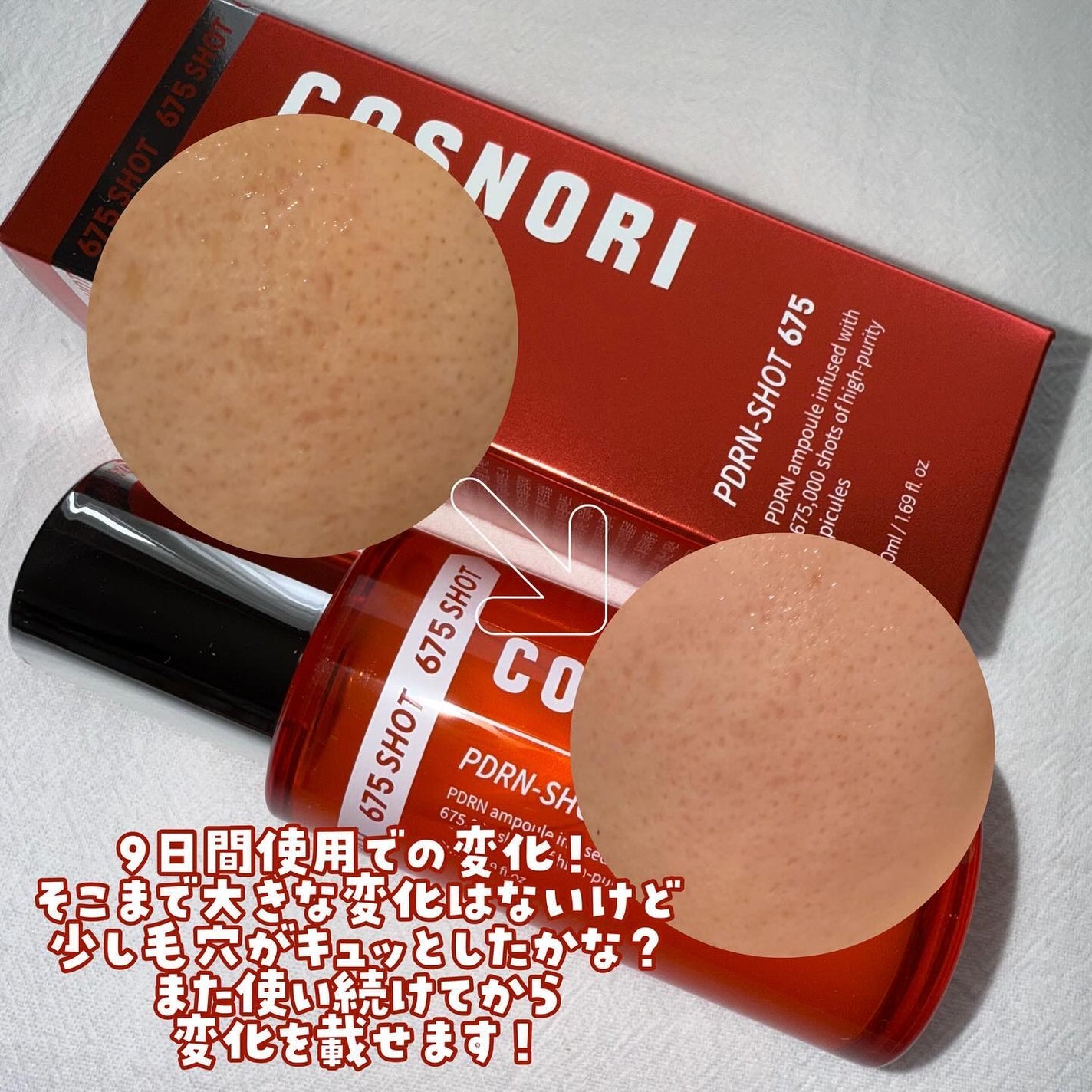 Kara on LIPS 「.COSNORI(@cosnori_jp)❤︎PDRNショット..」(5枚目)