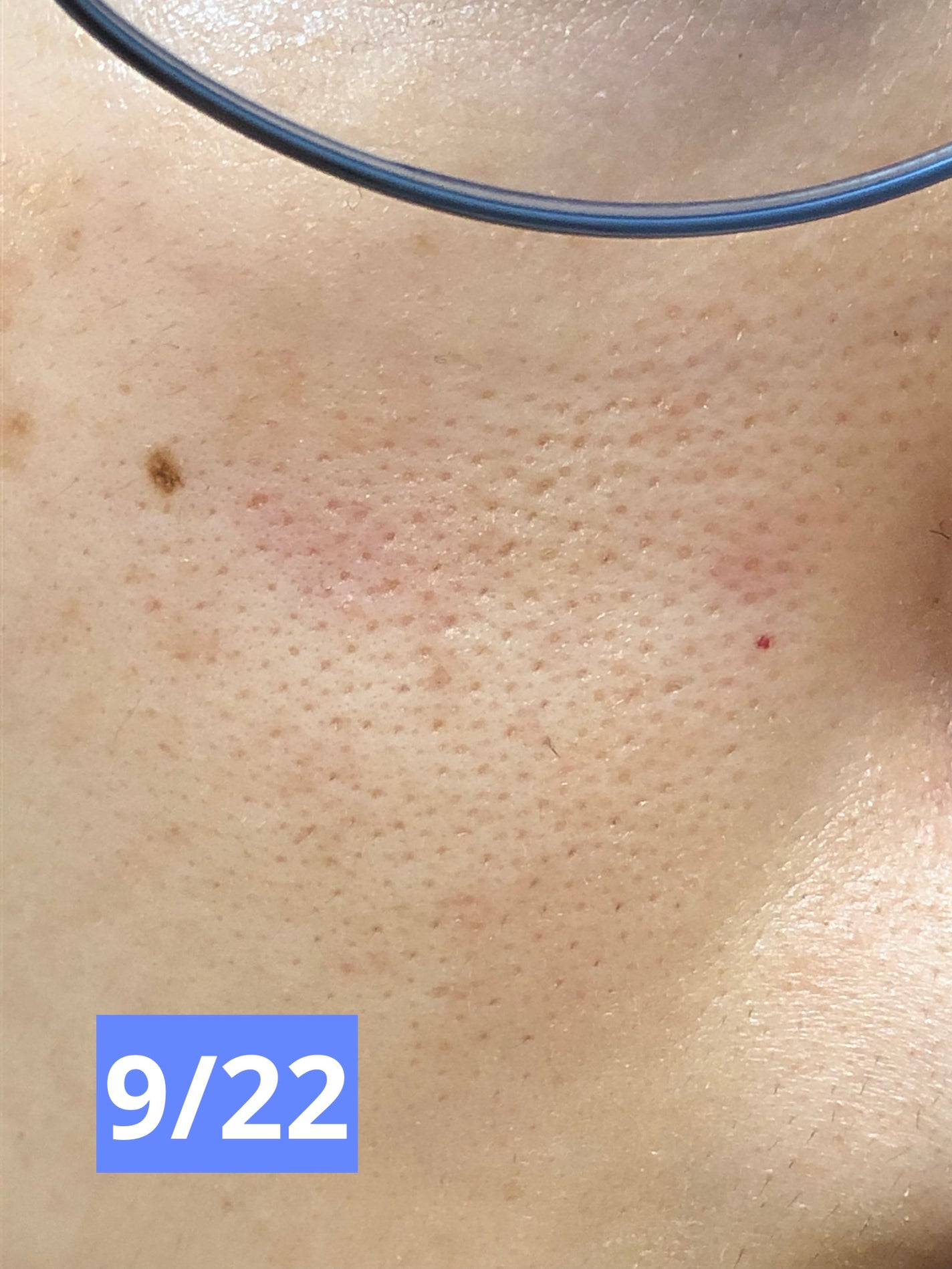 スキンライトセラピーII/Makeon/美顔器・マッサージを使ったクチコミ(3枚目)