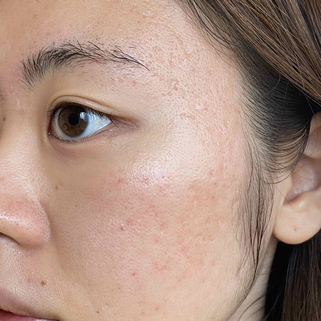 化粧水・敏感肌用・しっとりタイプ/無印良品/化粧水を使ったクチコミ(1枚目)