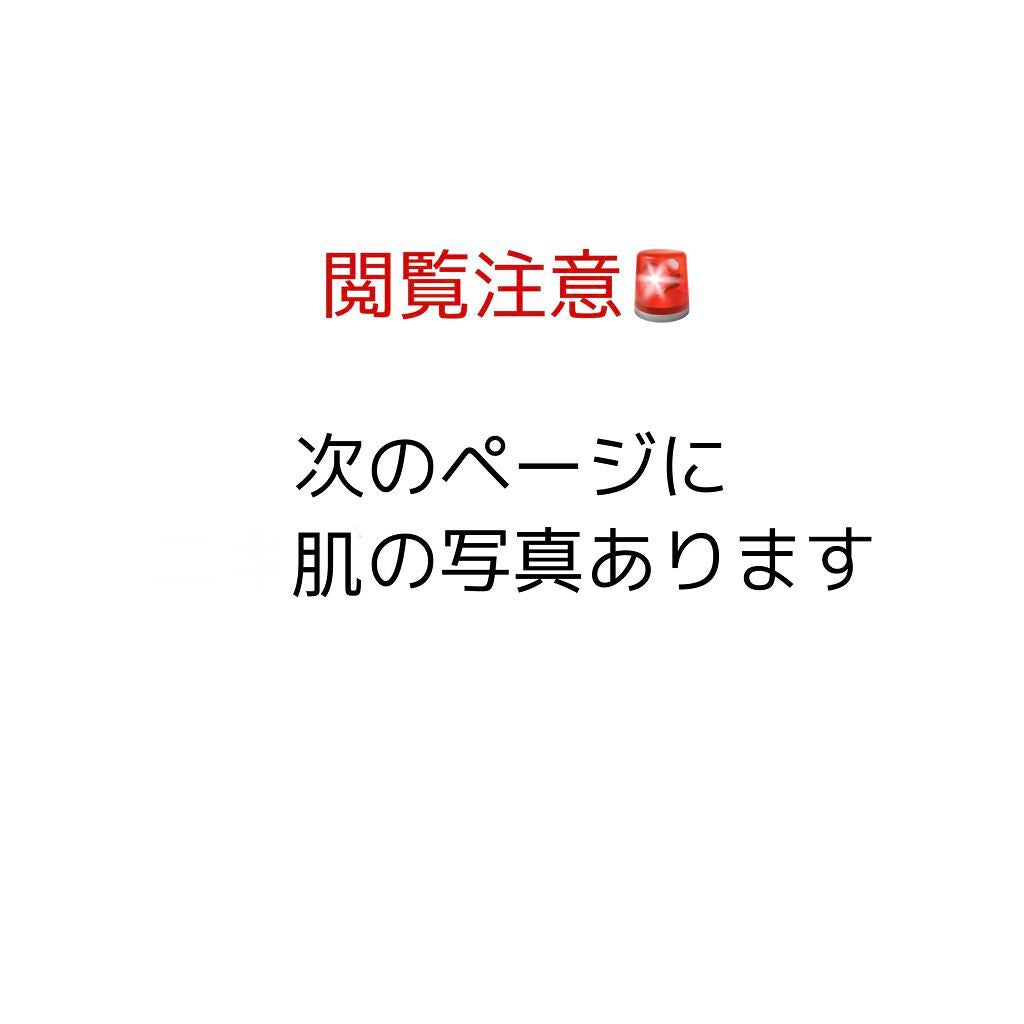 のの on LIPS 「ニキビ撲滅日記part5進展あり!!助けてください😭🙇♀️お..」(2枚目)