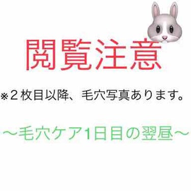 ＝＝＝＝＝＝＝＝＝＝＝＝
毛穴撲滅記vol.2のその後
＝＝＝＝＝＝＝＝＝＝＝＝

1日目終了後の翌日、化粧済昼間に撮った毛穴ものせときます。ご丁寧に左側と右側。インカメがダメなのかもと思い、外カメで撮