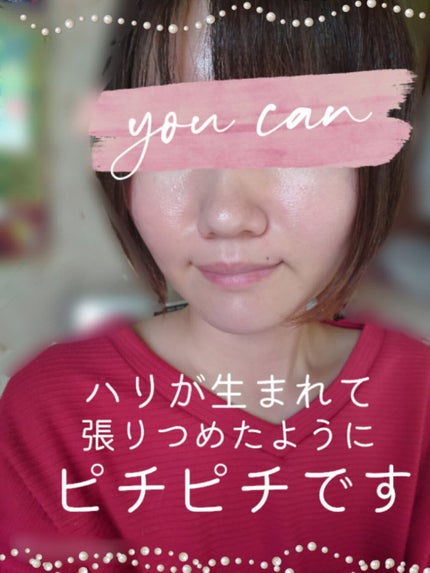 ã¬ãããŒã«A 1% ã¢ããã³ã¹ããªãã€ã¿ãªãŒãŒã·ã§ã³ã¯ãªãŒã /Life-flo/ãã§ã€ã¹ã¯ãªãŒã ã䜿ã£ãã¯ãã³ãïŒ3æç®ïŒ