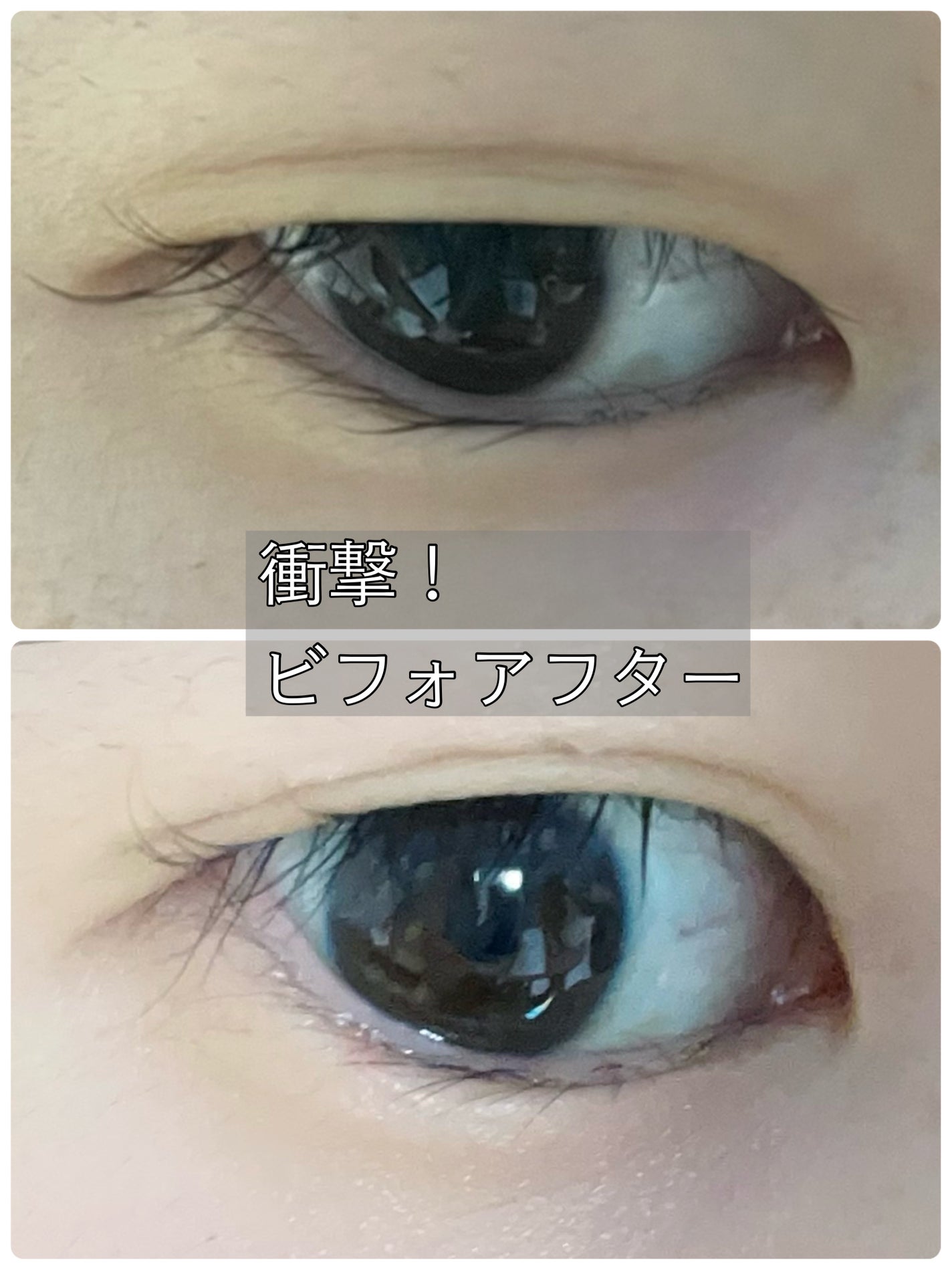 マイクロファイバー /ビー・エヌ/二重まぶた用アイテムを使ったクチコミ(1枚目)