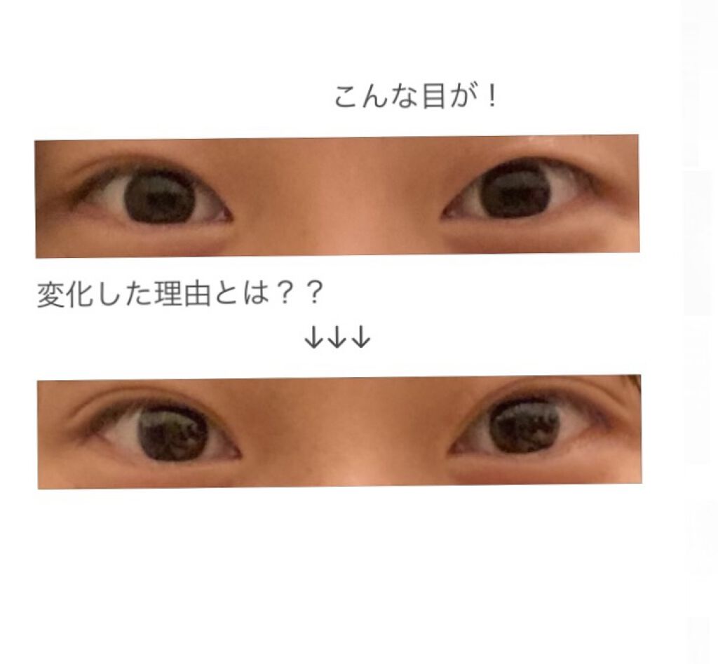 二重になる方法 ヘアピン Luckyの使い方や二重メイク 片方奥二重の私が二重に By Julie 普通肌 10代前半 Lips 二重になる方法 ヘアピン Luckyの使い方や二重メイク 片方奥二重の私が二重に By Julie 普通肌 10代前半 Lips