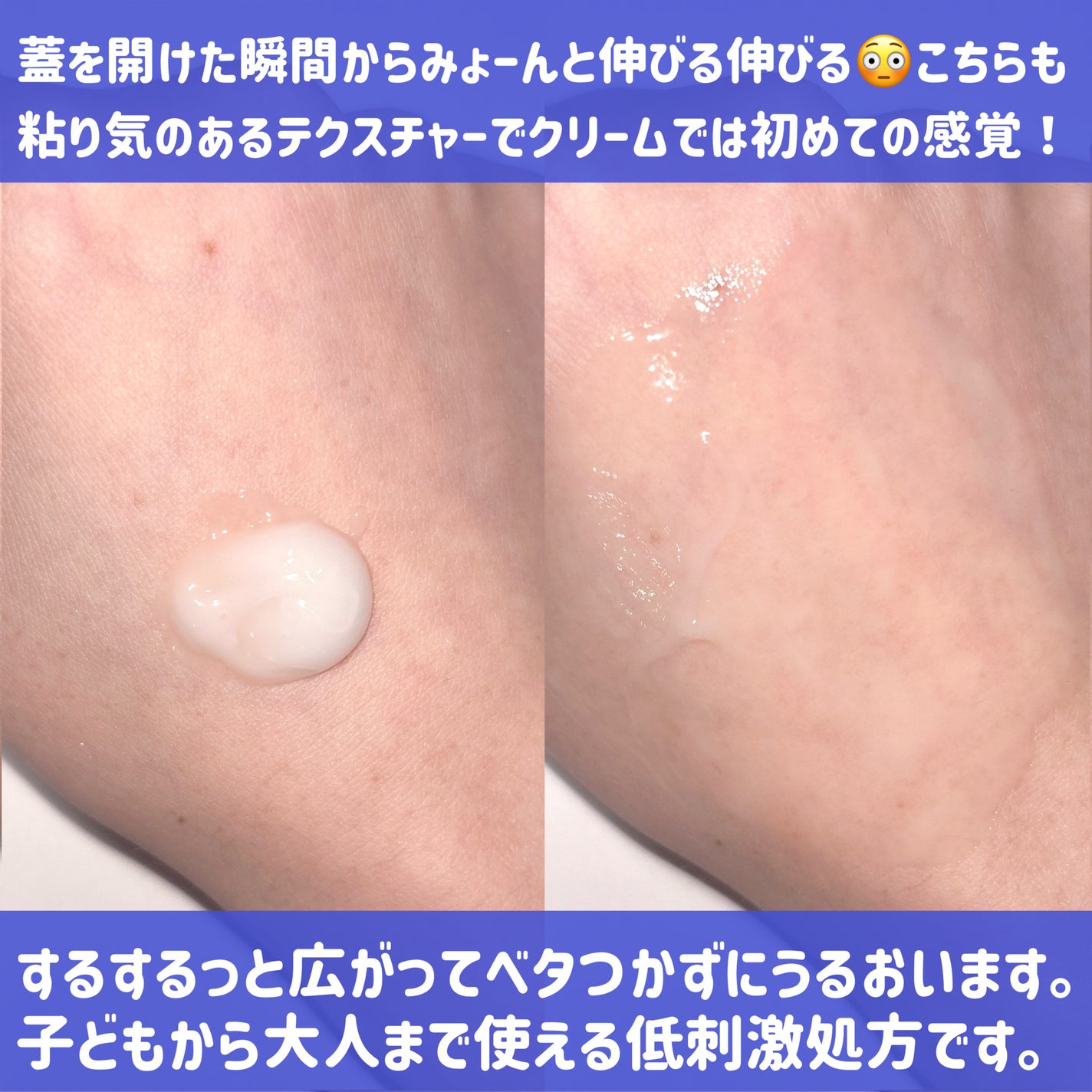 グルカミューンクリーム/VT/フェイスクリームを使ったクチコミ(5枚目)