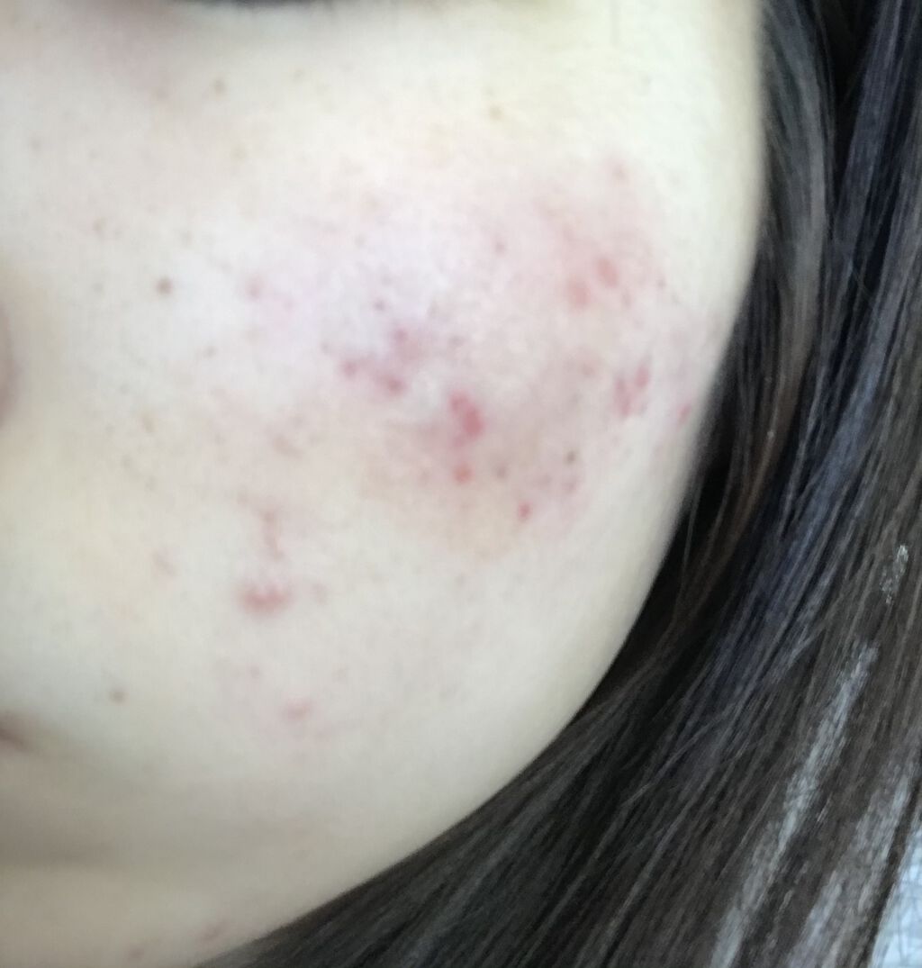 化粧水・敏感肌用・高保湿タイプ/無印良品/化粧水を使ったクチコミ（2枚目）