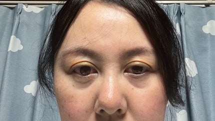 アレルバリア エッセンス BB N/d プログラム/BBクリームを使ったクチコミ(2枚目)