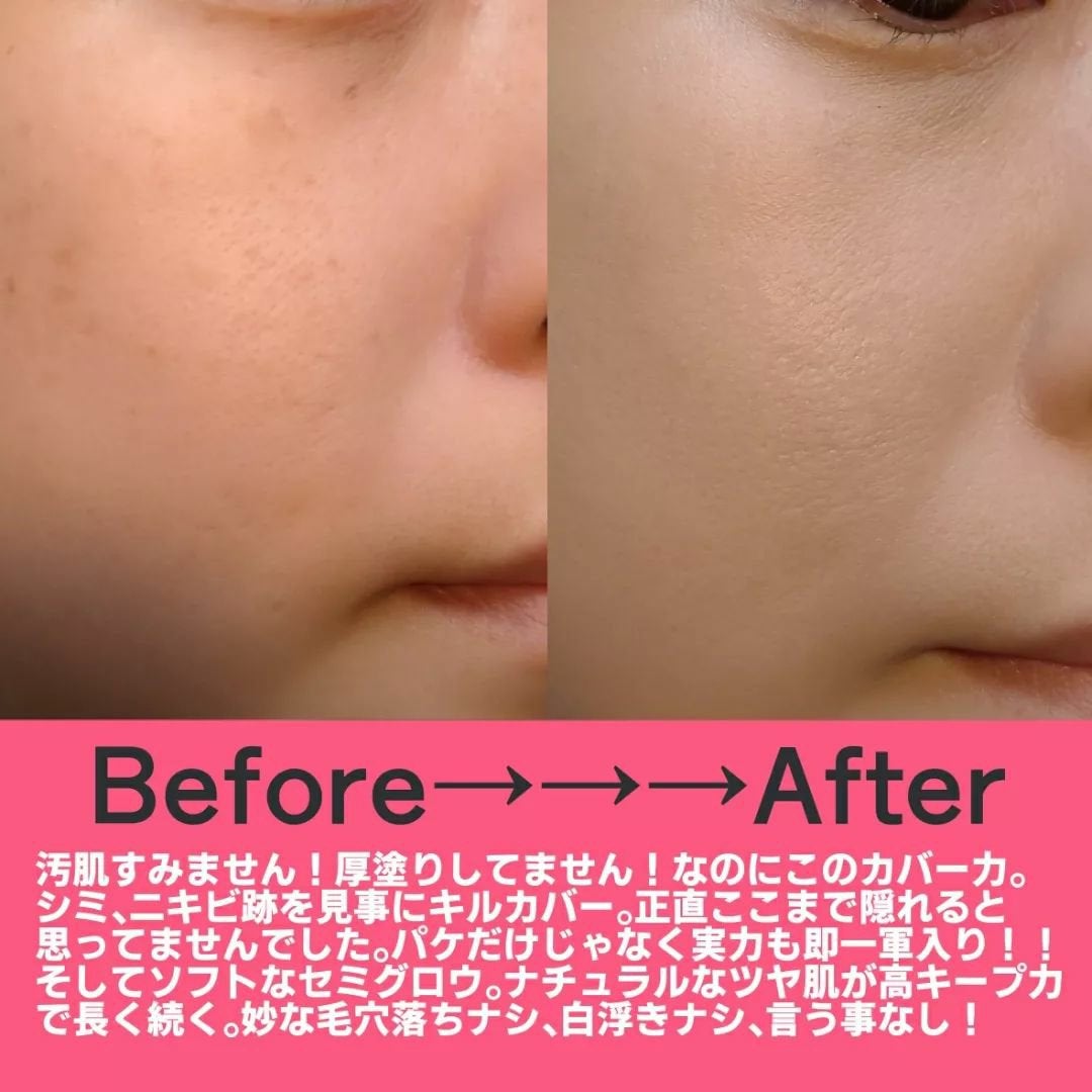 キル カバー メッシュ グロウ クッション/CLIO/クッションファンデーションを使ったクチコミ(4枚目)