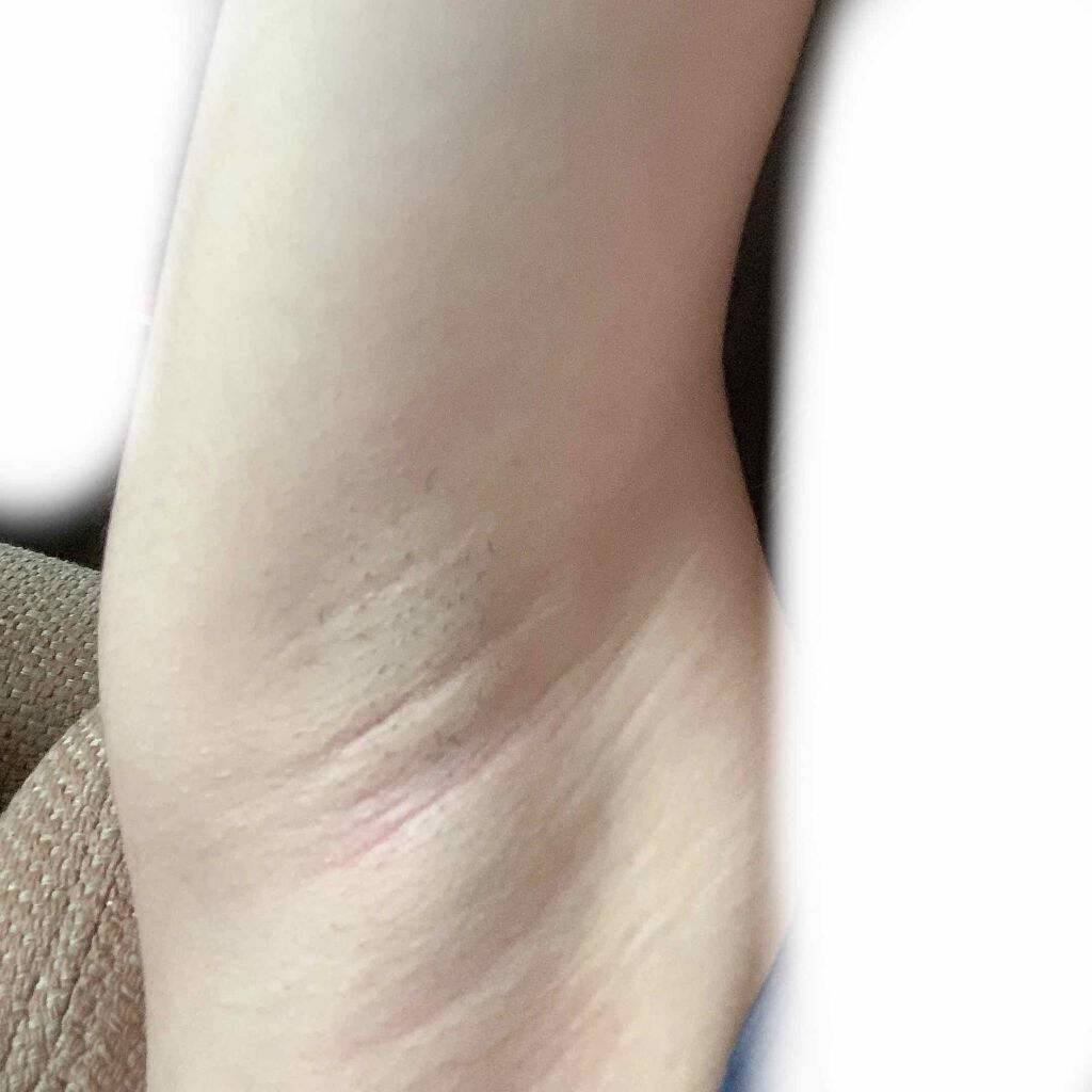 脱毛クリーム MOOMO/自然化粧品研究所/除毛クリームを使ったクチコミ(3枚目)