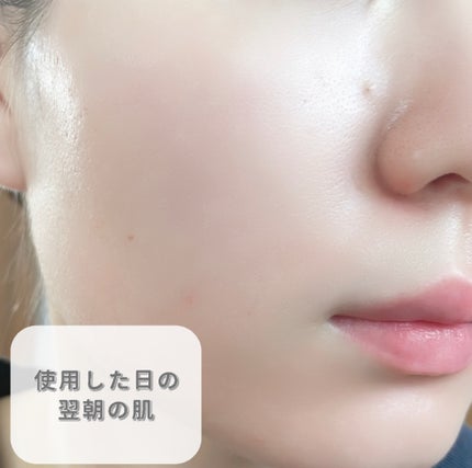 ピンクティーツリーマスクパック/APLIN/シートマスク・パックを使ったクチコミ(5枚目)