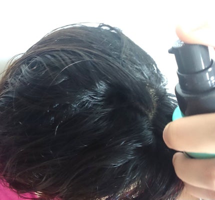 メディカルスカルプスパエッセンス/ティアレラプラス/頭皮ローションを使ったクチコミ(4枚目)