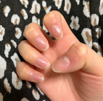 ナイトリニューハンドクリーム/コエンリッチQ10/ハンドクリームを使ったクチコミ(6枚目)