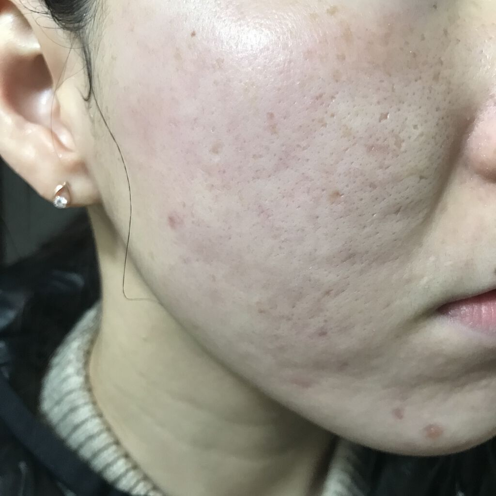 シルコット うるうるコットン/シルコット/コットンを使ったクチコミ（1枚目）