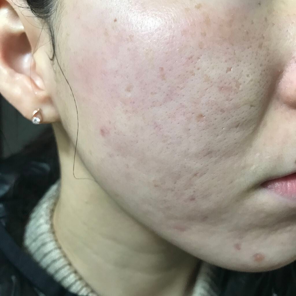 シルコット うるうるコットン/シルコット/コットンを使ったクチコミ(1枚目)