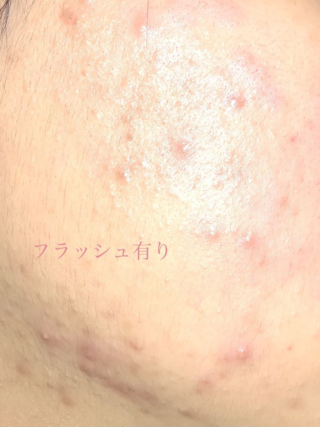 どくだみ化粧水(ナチュラルスキンローション)/CHINOSHIO/化粧水を使ったクチコミ（2枚目）