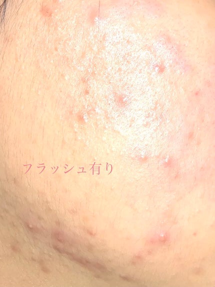 明色美顔水 薬用化粧水/美顔/化粧水を使ったクチコミ(2枚目)