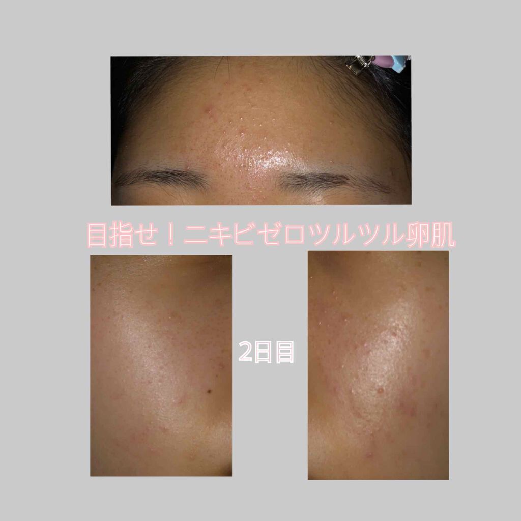 ぴぴ on LIPS 「メイクしてなくても、コールドクリーム使うの良いって聞いたから使..」(1枚目)