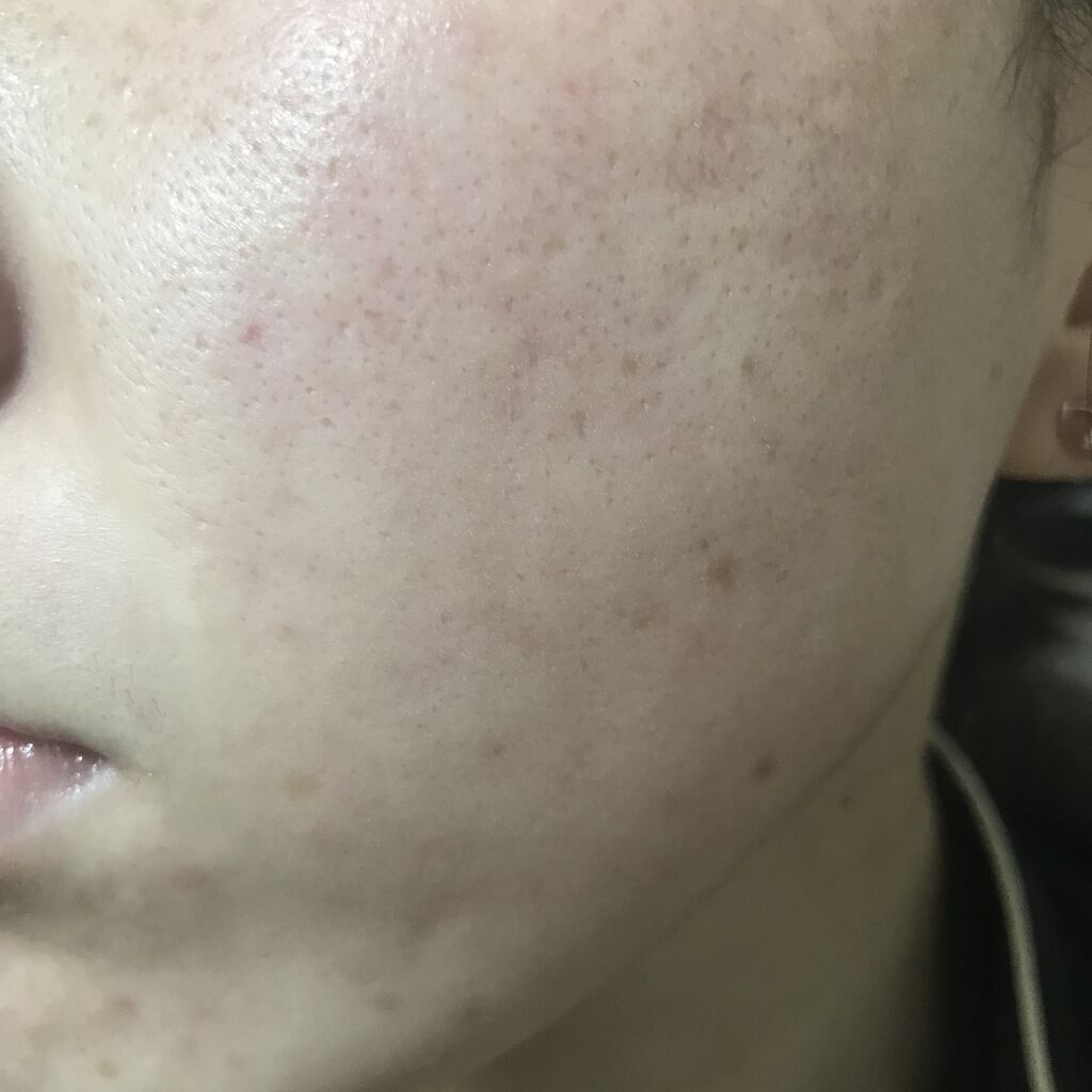 レチノールA 1% アドバンスドリバイタリゼーションクリーム/Life-flo/フェイスクリームを使ったクチコミ（2枚目）