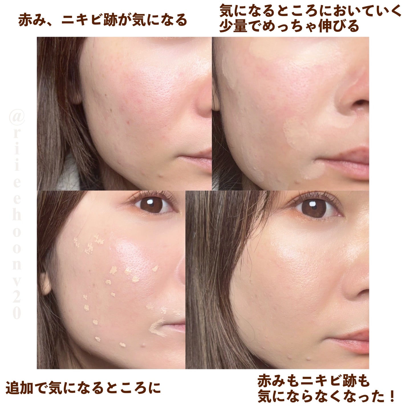 ダーマシンコンシーラー/23years old/リキッドコンシーラーを使ったクチコミ(2枚目)