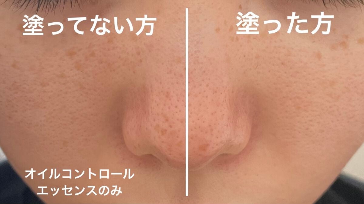 オイルコントロールカプセルエッセンス/celimax/美容液を使ったクチコミ(4枚目)