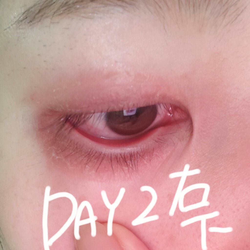 豆腐さんっ(現在マツ育日記の人) on LIPS 「まつ育日記Day3いや。もう結果出たのでは??爆笑やる意味ある..」(8枚目)