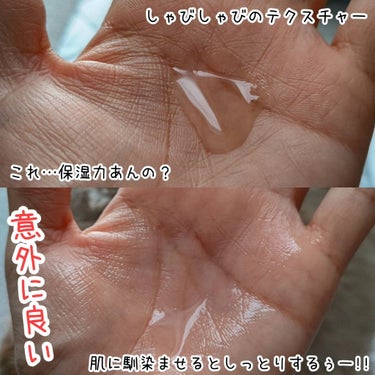 ヘパトリート 薬用保湿化粧水/ゼトックスタイル/化粧水を使ったクチコミ（2枚目）