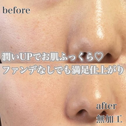 グロウ サン クッション/mgb skin/クッションファンデーションを使ったクチコミ(6枚目)