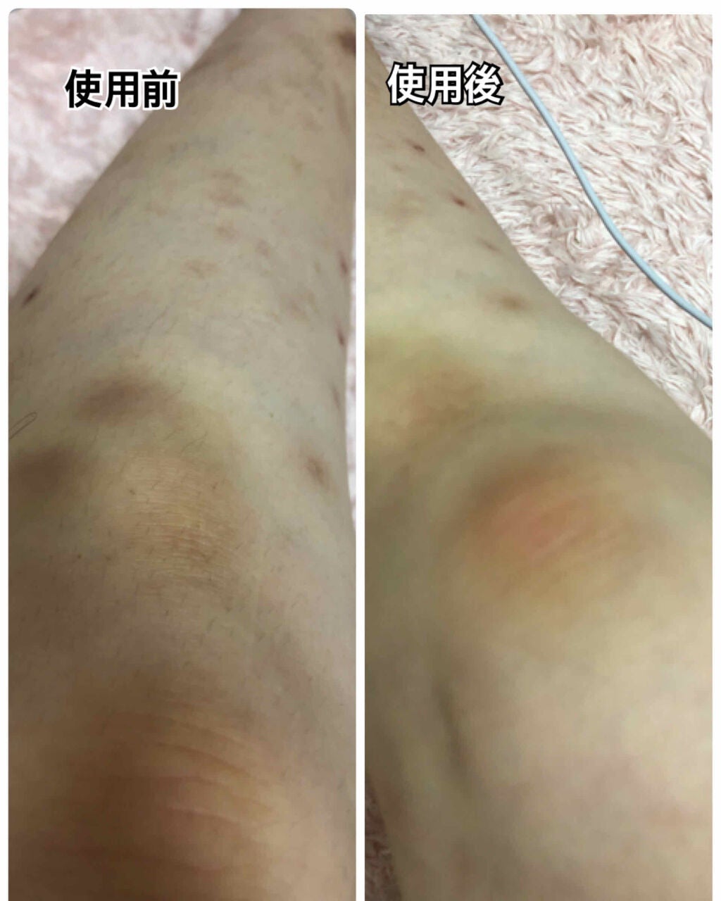 脱毛クリーム MOOMO/自然化粧品研究所/除毛クリームを使ったクチコミ(2枚目)