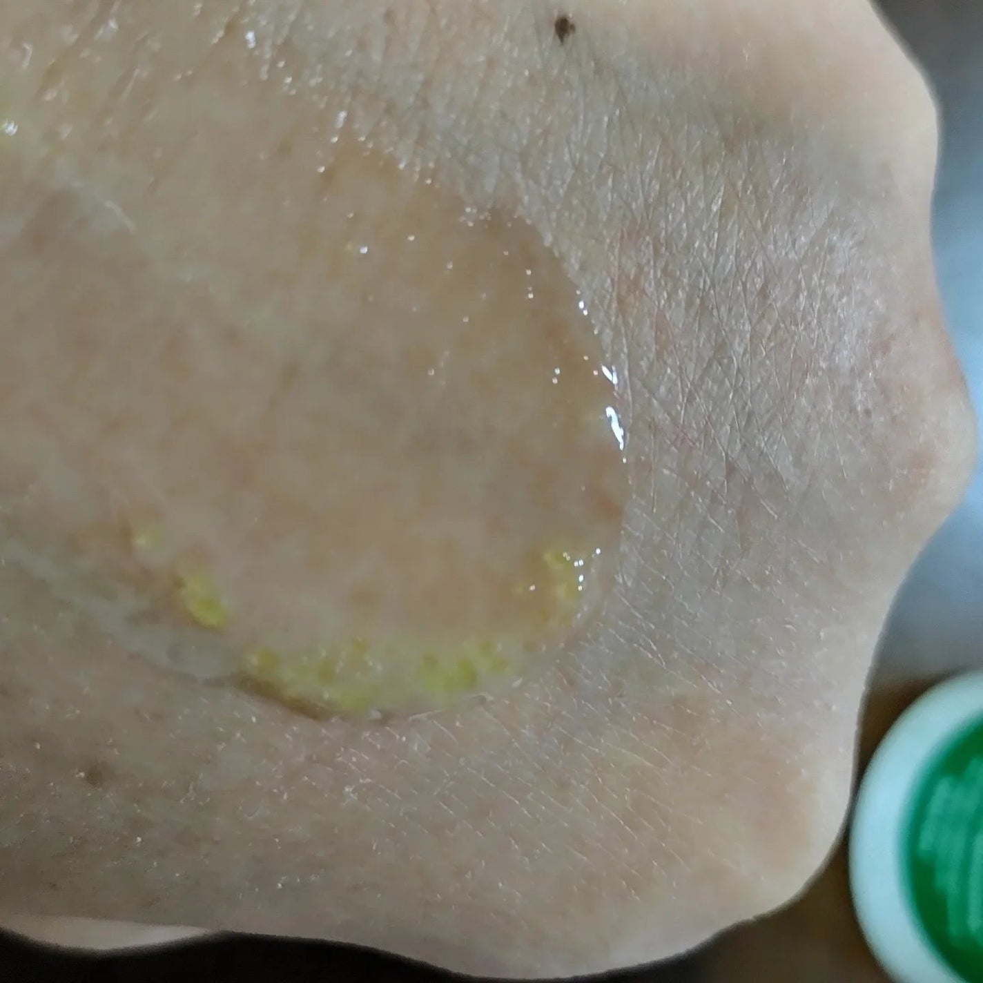 マミー on LIPS 「このレビューはCKDレチノコラーゲン低分子300パンピングアン..」(2枚目)