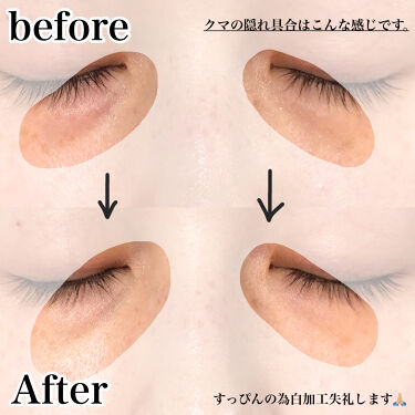 茶クマで悩む人必見 原因はコレ 今すぐできるケア方法やおすすめのアイテムを紹介 Lips 茶クマで悩む人必見 原因はコレ 今すぐできるケア方法やおすすめのアイテムを紹介 Lips