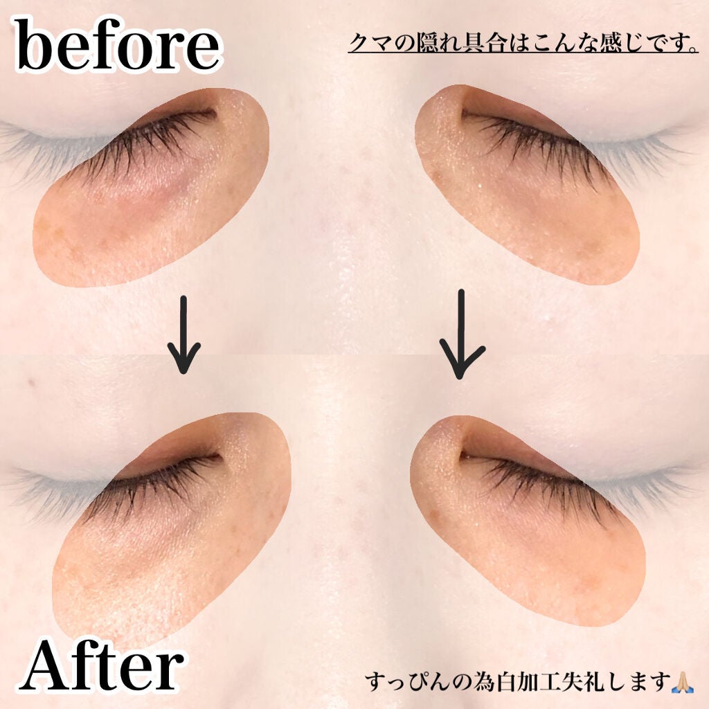 &be ファンシーラー/&be/パレットコンシーラーを使ったクチコミ(3枚目)