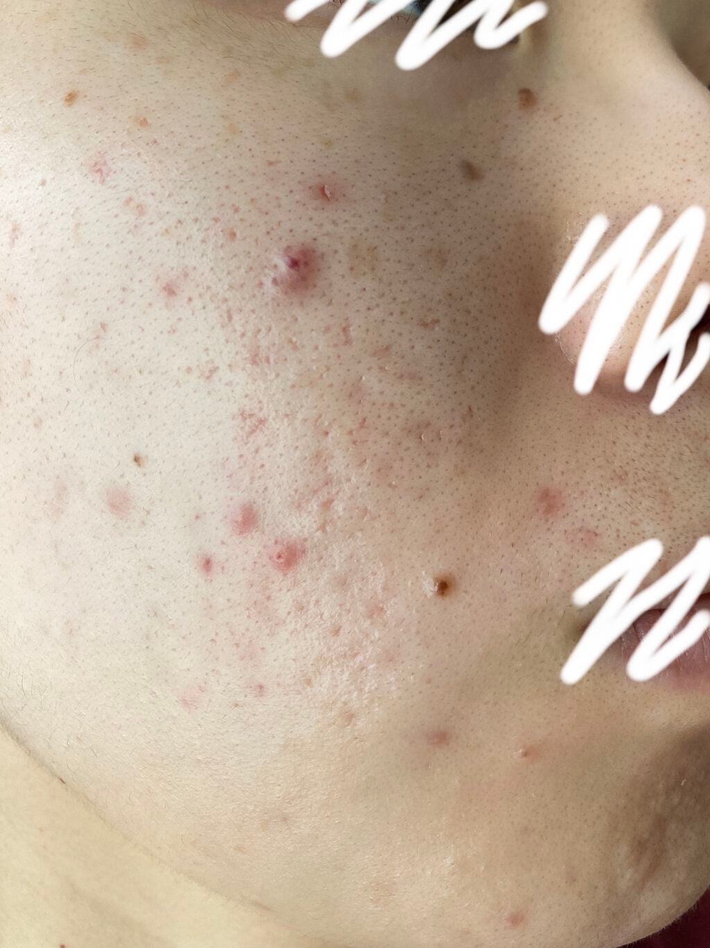 モイスチャージェル2/エンビロン/フェイスクリームを使ったクチコミ(4枚目)