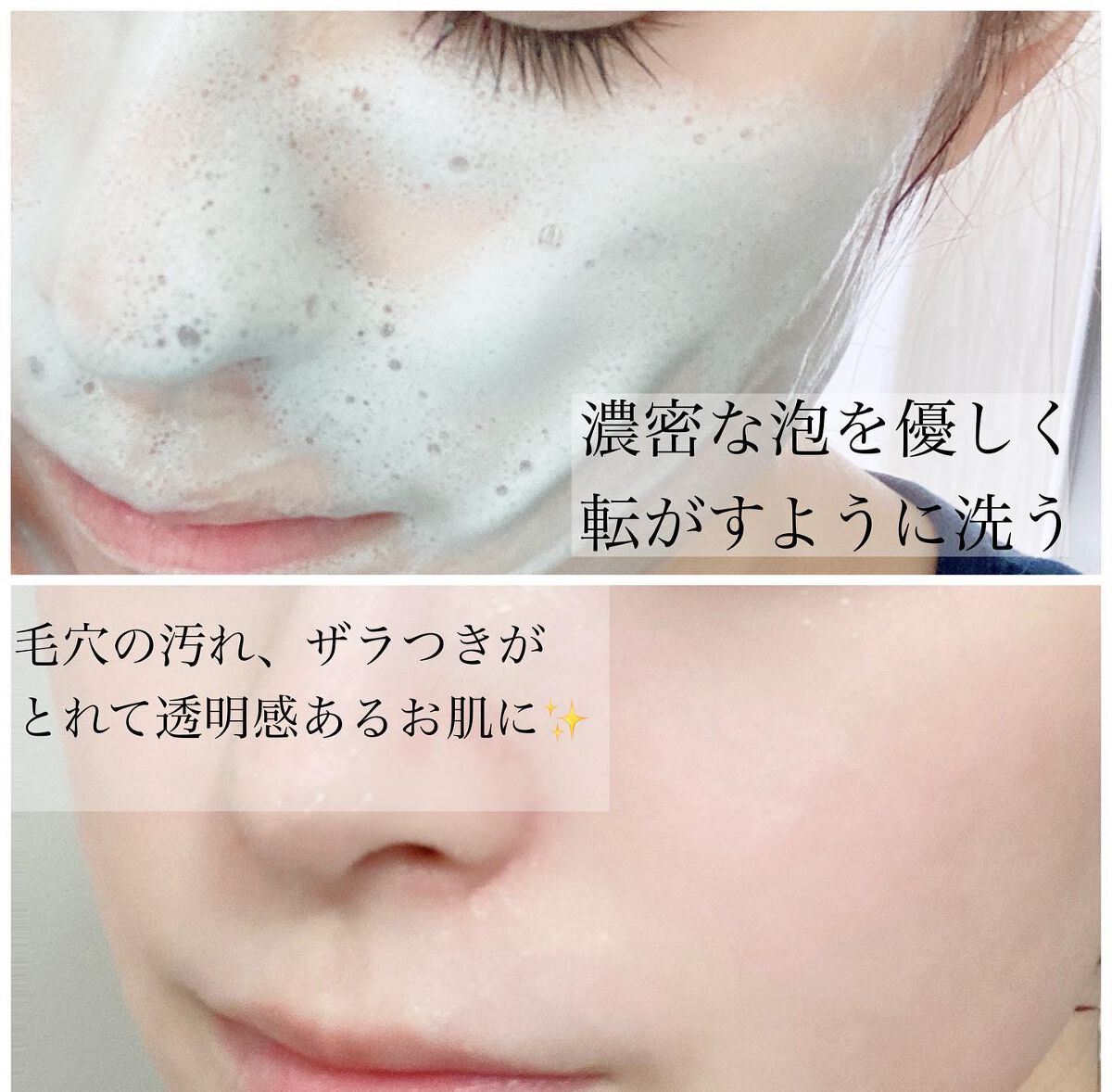 みーぴょん on LIPS 「▷▶▷fonskin*⌒⌒⌒⌒⌒⌒⌒⌒⌒⌒⌒⌒⌒⌒⌒⌒*あのチ..」(4枚目)